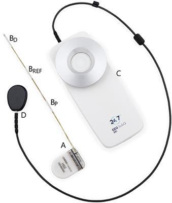 Expert Perspective: Who May Benefit Most From the New Ultra Long-Term Subcutaneous EEG Monitoring?